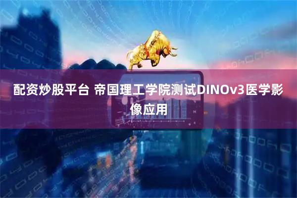 配资炒股平台 帝国理工学院测试DINOv3医学影像应用